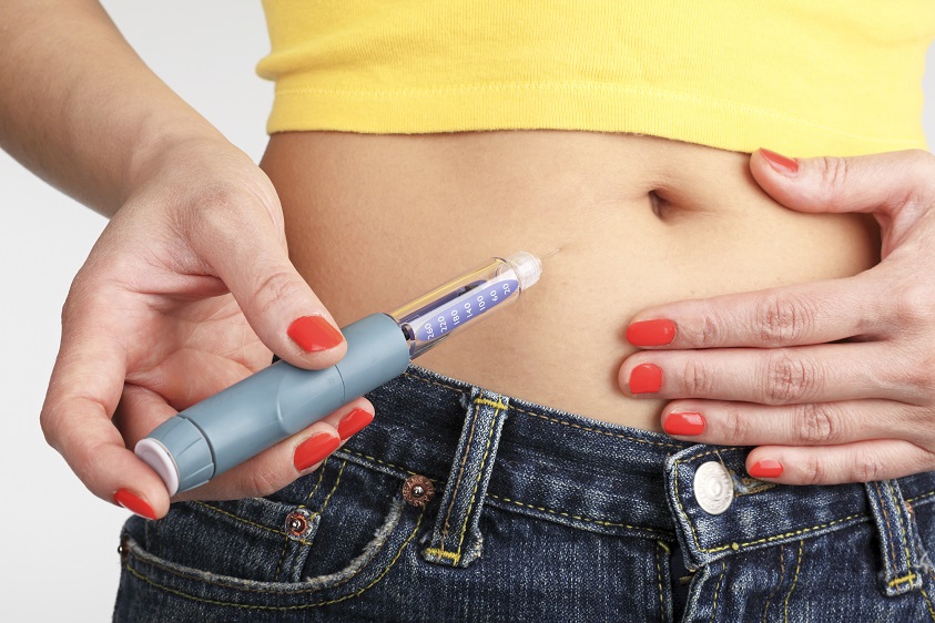 Polycystic Ovary Syndrome